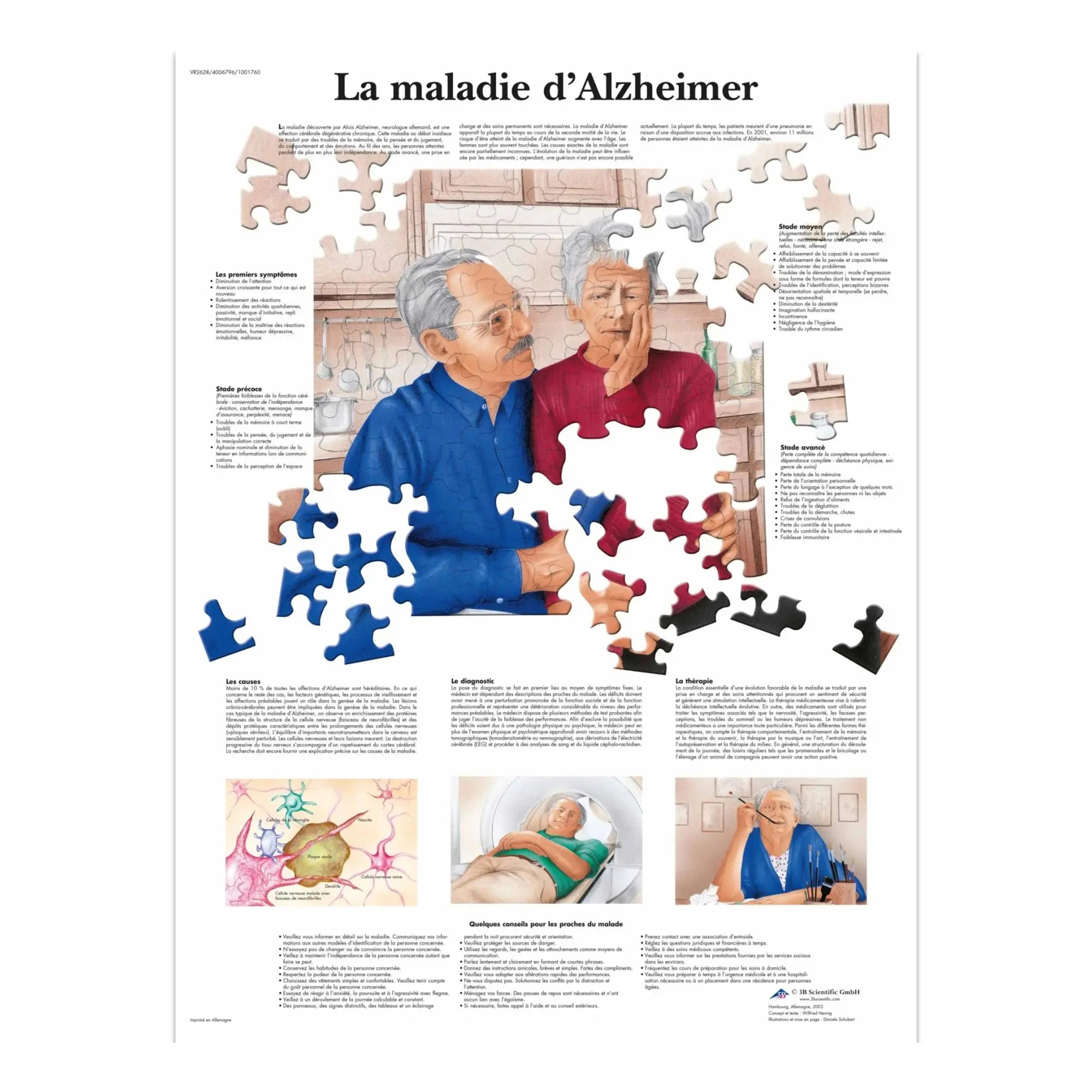 Anatomical board - Alzheimer's disease - Anatomy and pathology